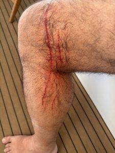 Zweikampf verloren?!